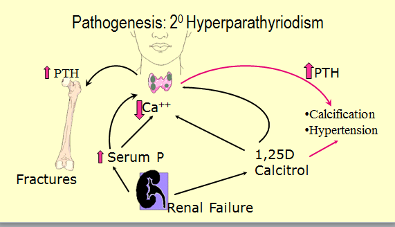 Diagram of pathogenesis of tertiary hyperparathyroidism