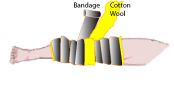 Robert Jones Bandage
