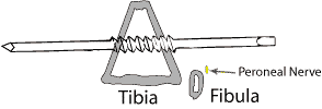 Cross section of tibia at level of Denham pin