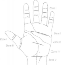 Flexor tendon zones in the hand