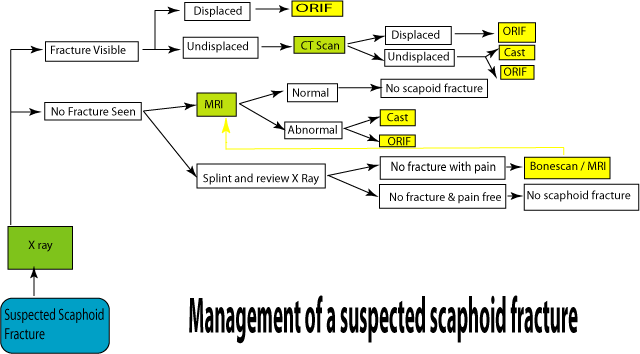 Management of a suspected scaphoid fracture