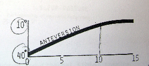 Graph of femoral anteversion vs age