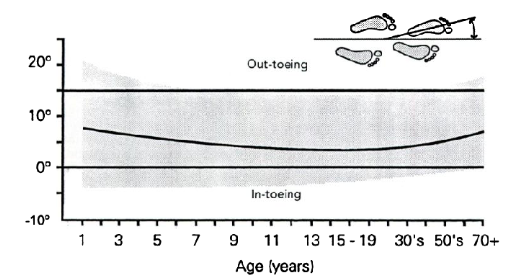 Foot progression angle and age