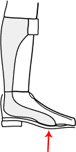 Ankle Foot Orthosis