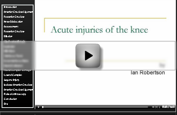 Play knee ligament video