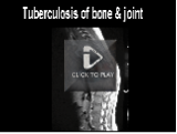 Click to view TB Screencast (flash video)